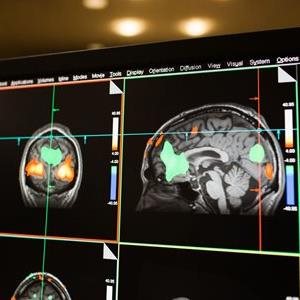 Baycrest receives $1.8 million federal grant to boost research infrastructure