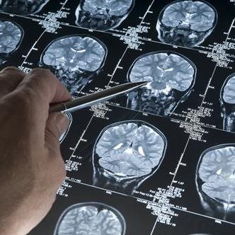 Grants allow Baycrest to dive into uncharted areas in brain health research